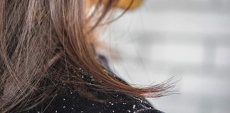 Eradicate The Problem Of Dandruff Once And For All