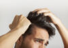 Hair Loss PRP Treatment in Delhi