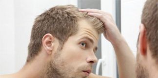 4 Ways to Manage Your Receding Hairline