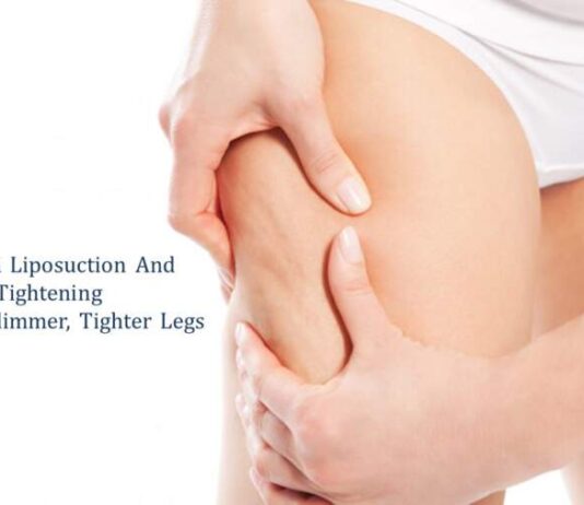Skin Tightening and Liposuction